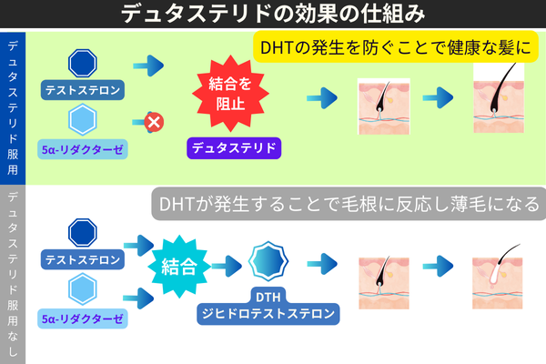 デュタステリドの効果の仕組み