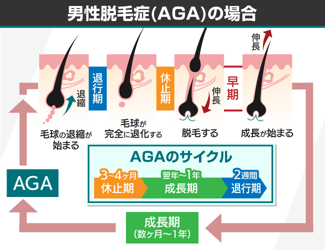 乱れたヘアサイクル