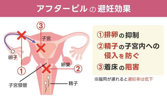 マドンナの避妊効果